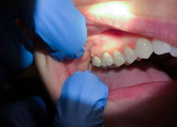 Best Walk-In Emergency Dental Services in Gretna, VA