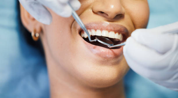Best Knocked-Out Tooth (Avulsed Tooth) Treatment in Gretna, VA